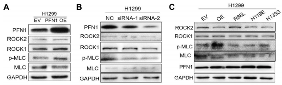 D7. westernӡEy(c)PFN1^(gu)ȱ_(d)(A)/ó(B)ĵױ_(d)/PF